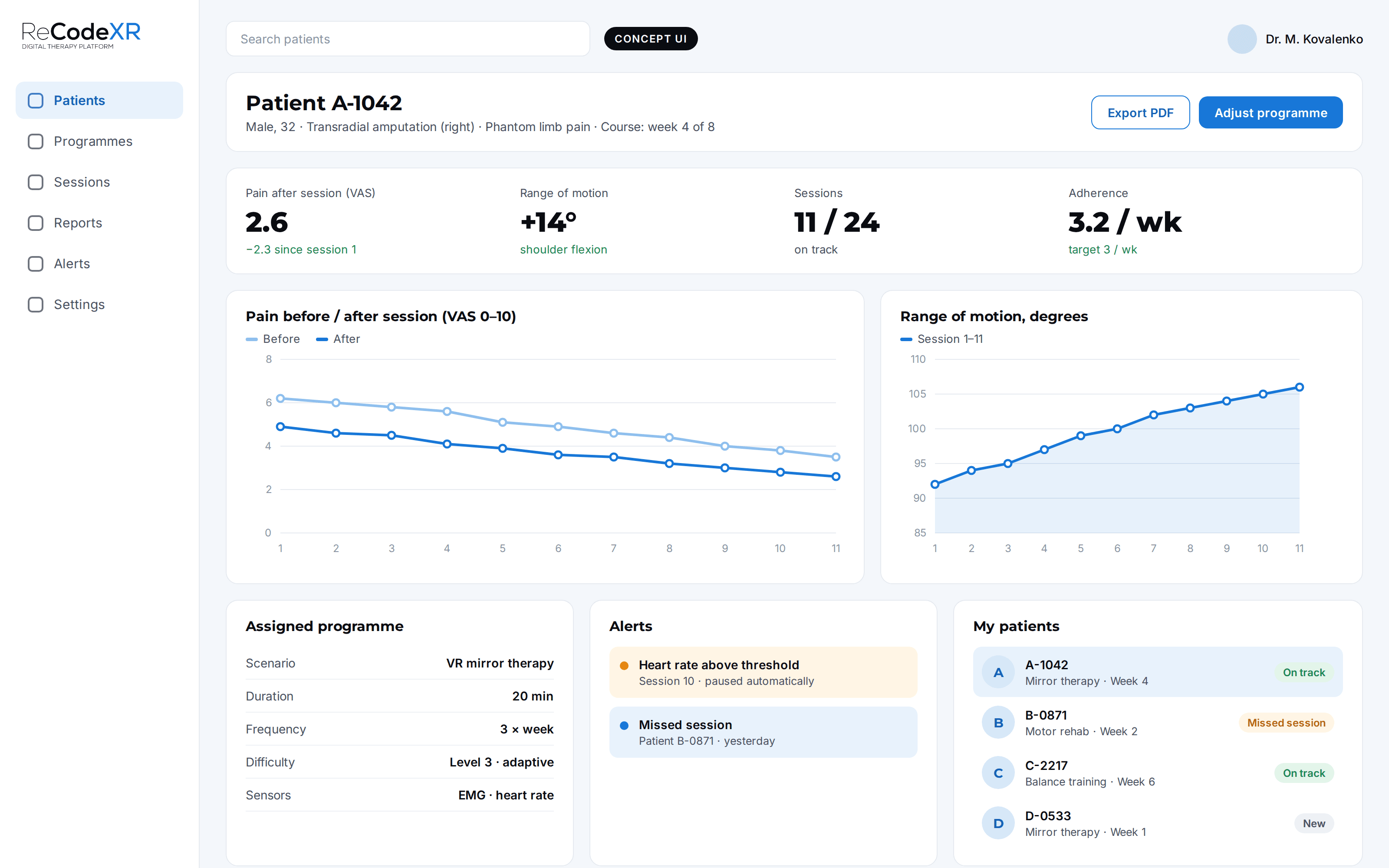 Concept UI of the clinician dashboard: patient A-1042, pain before and after sessions (VAS), range of motion, sessions, adherence, assigned programme, alerts and patient list.